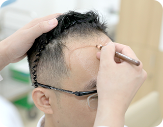 Xác định vùng cấy