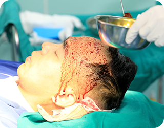 sát khuẩn vùng cấy