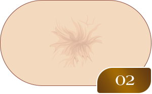 02
