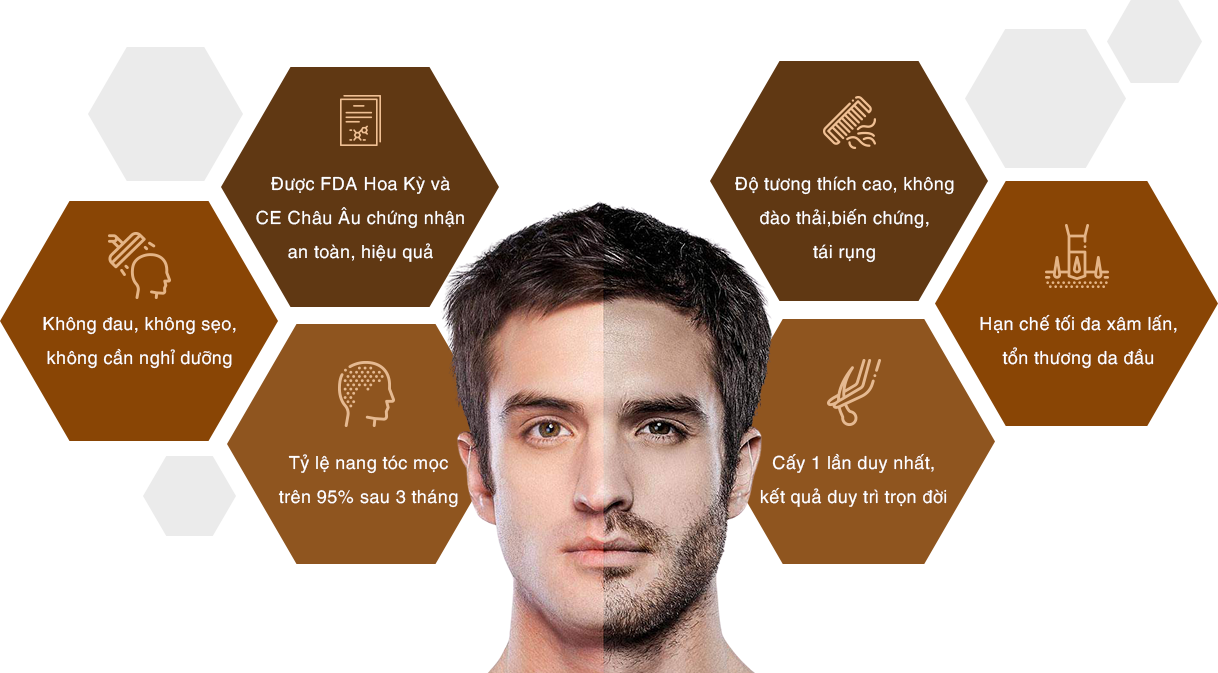 ƯU ĐIỂM VƯỢT TRỘI CỦA CÔNG NGHỆ CẤY TÓC TỰ THÂN