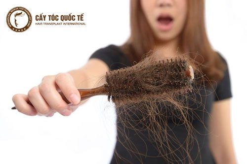 Nguyên nhân rụng tóc là gì? 