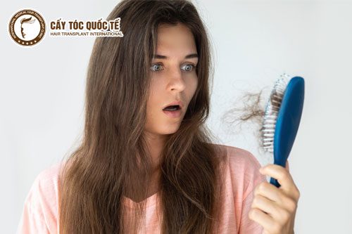 Đâu là nguyên nhân dẫn đến rụng tóc ở nữ giới?