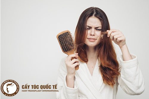 Rụng tóc nữ giới: Nguyên nhân và cách khắc phục hiệu quả