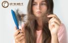 Cách chữa rụng tóc nhiều ở nữ giới không phải ai cũng biết