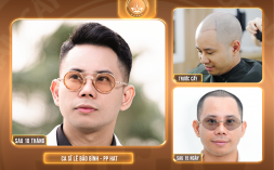 Hy vọng nào cho người trán cao bẩm sinh?
