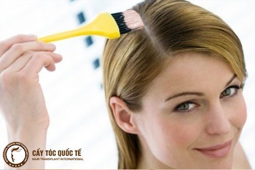 Lạm dụng hóa chất uốn nhuộm tóc quá nhiều ảnh hưởng đến da đầu cũng gây nên rụng tóc hói đầu