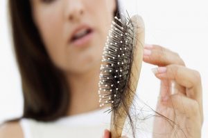 rụng tóc nguyên nhân và cách điêu trị