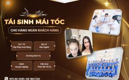Mách nhỏ địa chỉ cấy tóc tự thân giá tốt tại TP. Hồ Chí Minh